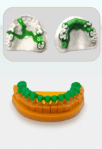 Dental Castable Resin Green - Image 2